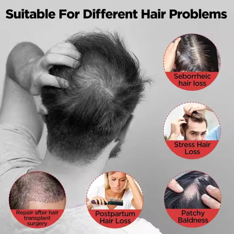 LumiHair™ Laser Cap